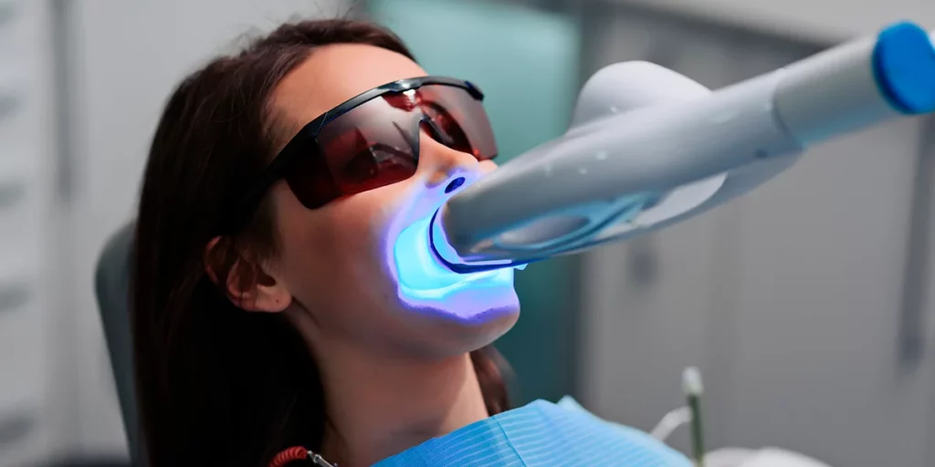 Tipos de blanqueamiento dental: ¿cuál es el más seguro y eficaz?